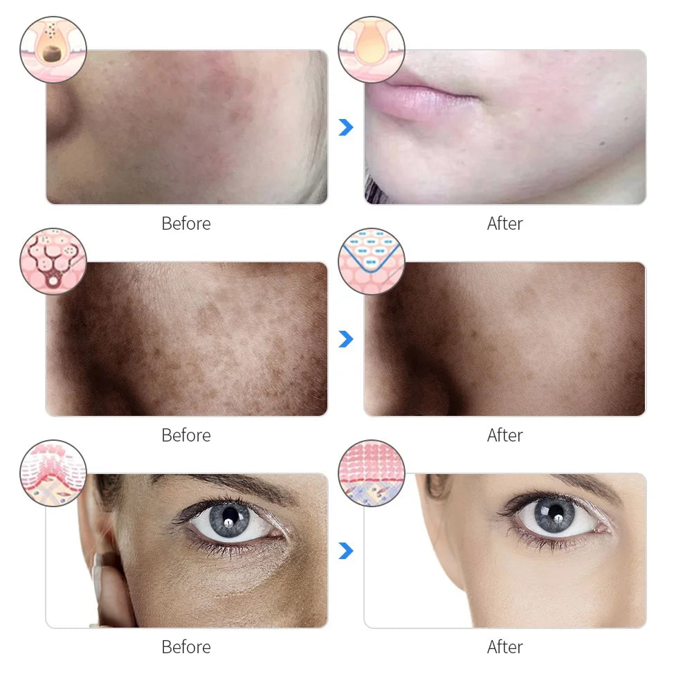 Mascarilla LED Facial Recargable de 7 Colores Máscara de Belleza con Fotones LED Rejuvenecimiento de la Piel Lifting Facial en Casa Blanqueamiento Cuidado de la Piel Máscara de Belleza