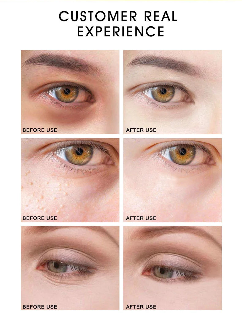 ARTISCARE SET de cuidado de la piel con oro de 24K, Crema facial, Suero hidratante, Esencia para ojeras, Productos coreanos para el cuidado de la piel