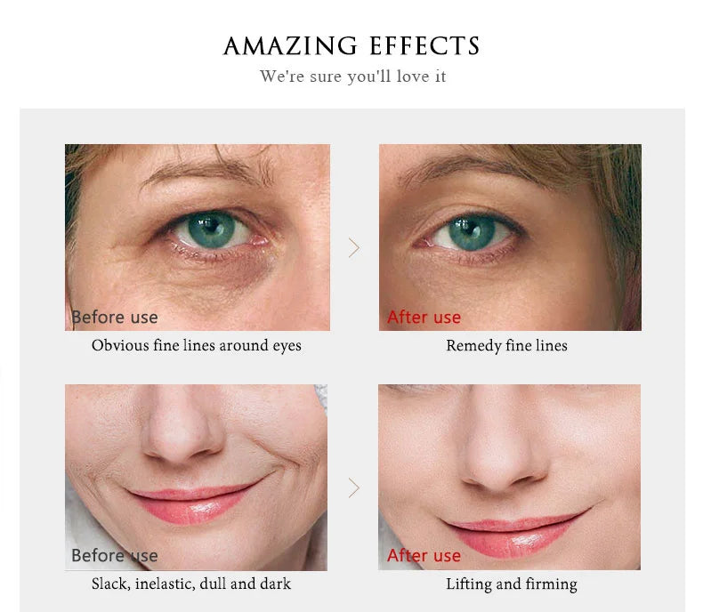 ARTISCARE SET de cuidado de la piel con oro de 24K, Crema facial, Suero hidratante, Esencia para ojeras, Productos coreanos para el cuidado de la piel
